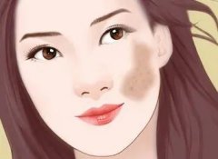 南京皮研所：色斑淡化的秘密