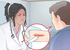 南京祛疤痕的正规医院